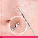 Stainless Steel Blackhead Remover Needle Acne Comedone Pimple Extractor hv2n