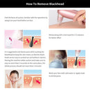 Vacuum Pore Cleaner Face Cleaning Blackhead Acne Removal Suction Black Spot