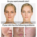 Greenlouch Pore Corset Serum 60ML