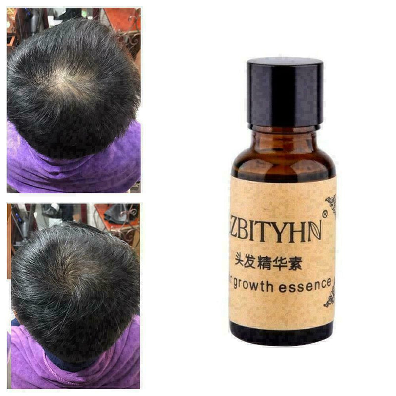 20ml Hair Care Growth Essence Anti Hair Loss Hairstyle Keratin Liquid Dense Y4F9