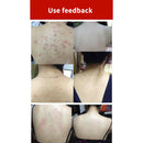 100G Sea Salt Soap Cleaner Removal Pimple Pores Acne Treatment Goat Milk Mo C4N4