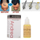 Hair Growth Inhibitor Essence Hair Loss 10 Days Fast Growth 2 Products Hair B8S1