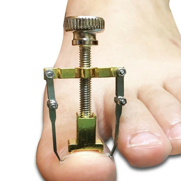 Pro Ingrown Toe Nail Recover Toenail Correction Pedicure Fixer Straighten DWY