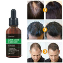 Hair Revitalizing Serum Ginger Fast Growth Essential Preventing Anti Oil Q4D7