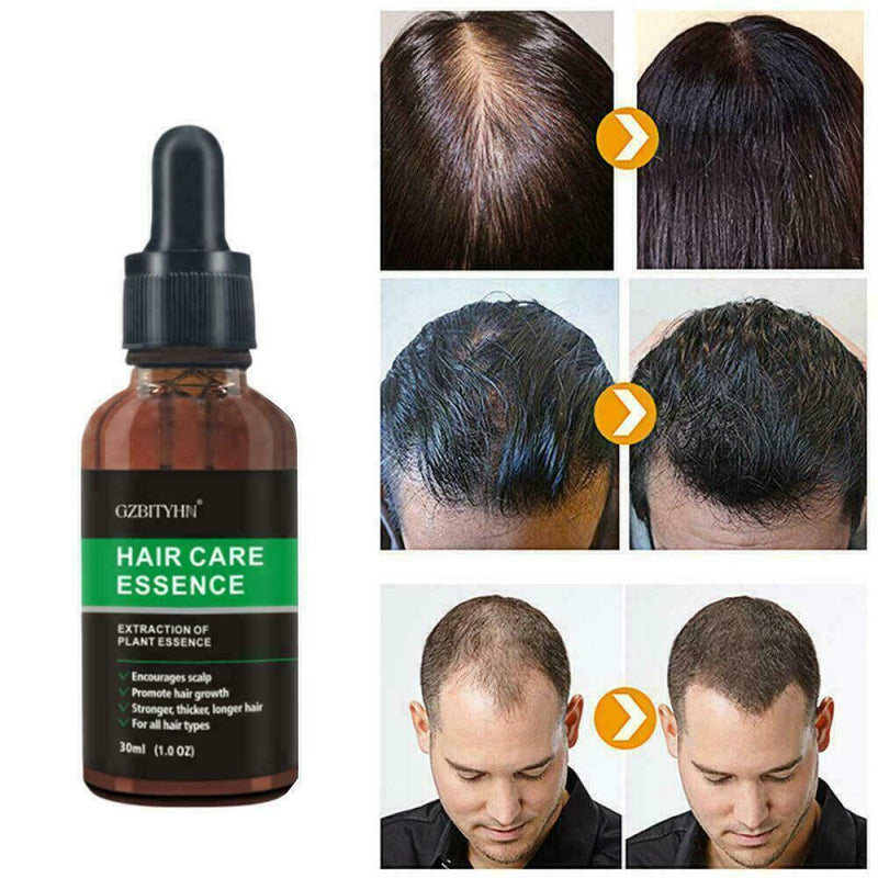 Hair Revitalizing Serum Ginger Fast Growth Essential Preventing Anti Oil Q4D7