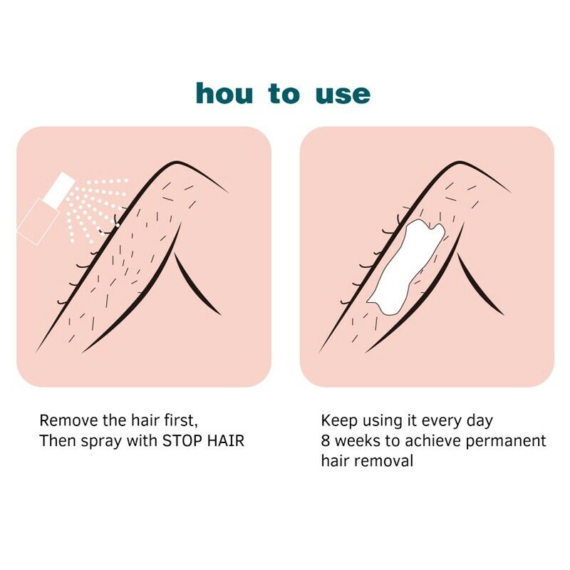 Lanthome Effective Permanent Hair Growth Inhibitor After Hair Removal Repai X6U3