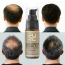 20ml PURC sale Fast Hair Growth Essence Oil Hair Loss K8B8 C Treatment M4Z4 P7R2