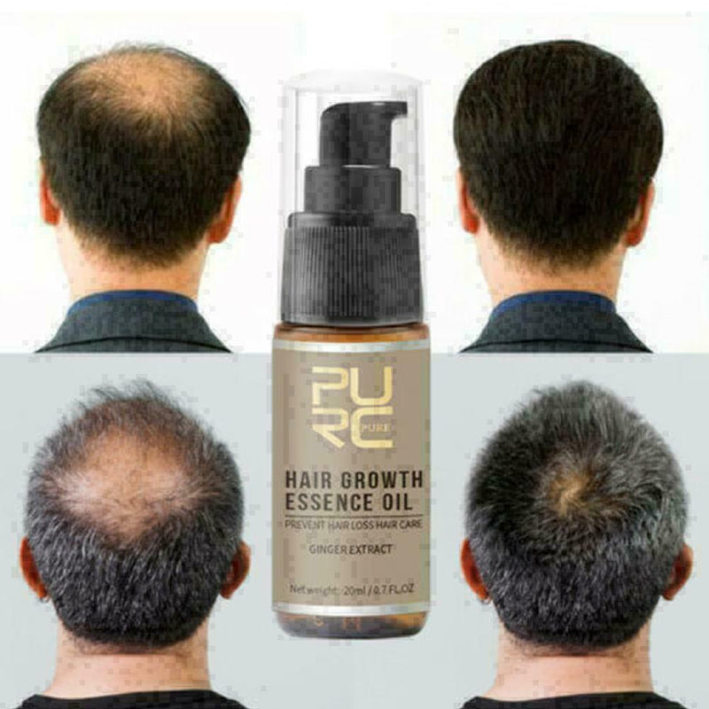 20ml PURC sale Fast Hair Growth Essence Oil Hair Loss K8B8 C Treatment M4Z4 P7R2