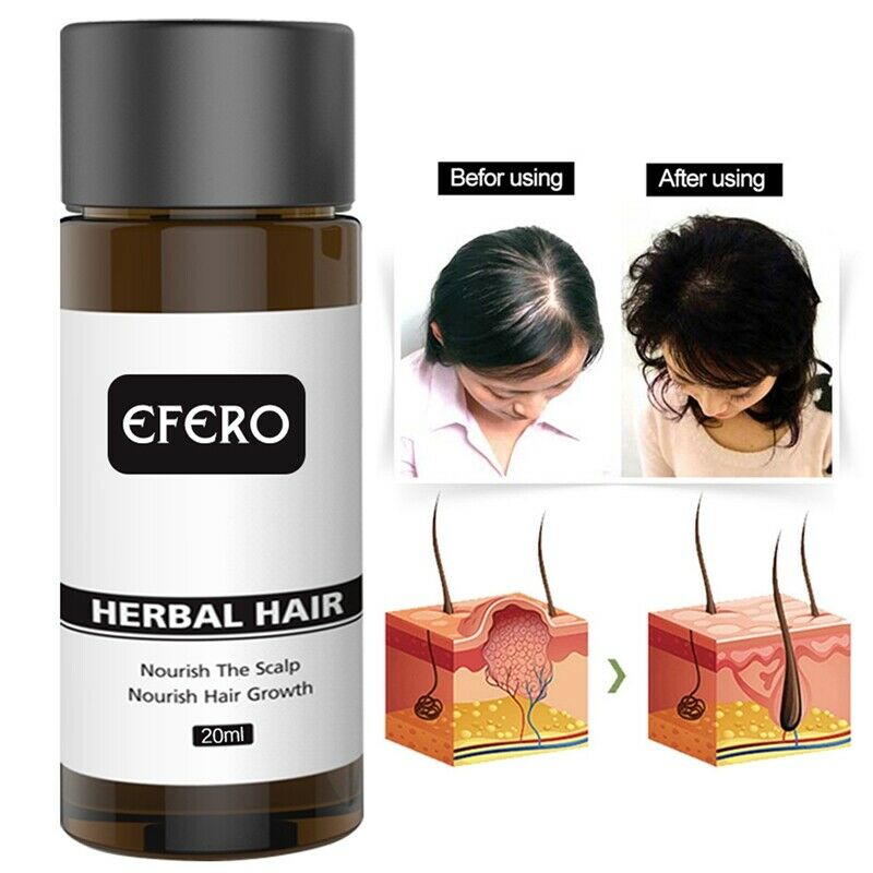 Efero Hair Growth Serum Oil Natural Essence Beard Growth Serum Faster Grow  I9S4