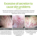 Vibrant Glamour Tea Tree Repair Face Serum Acne Scar Shrink Pores Face Seru I6N4