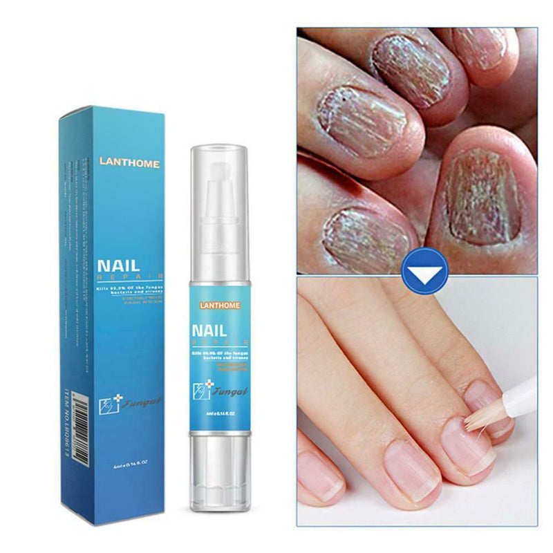 Nail Protection Liquid Repair Remove Liquid Bright Nails Gray Nail Pen