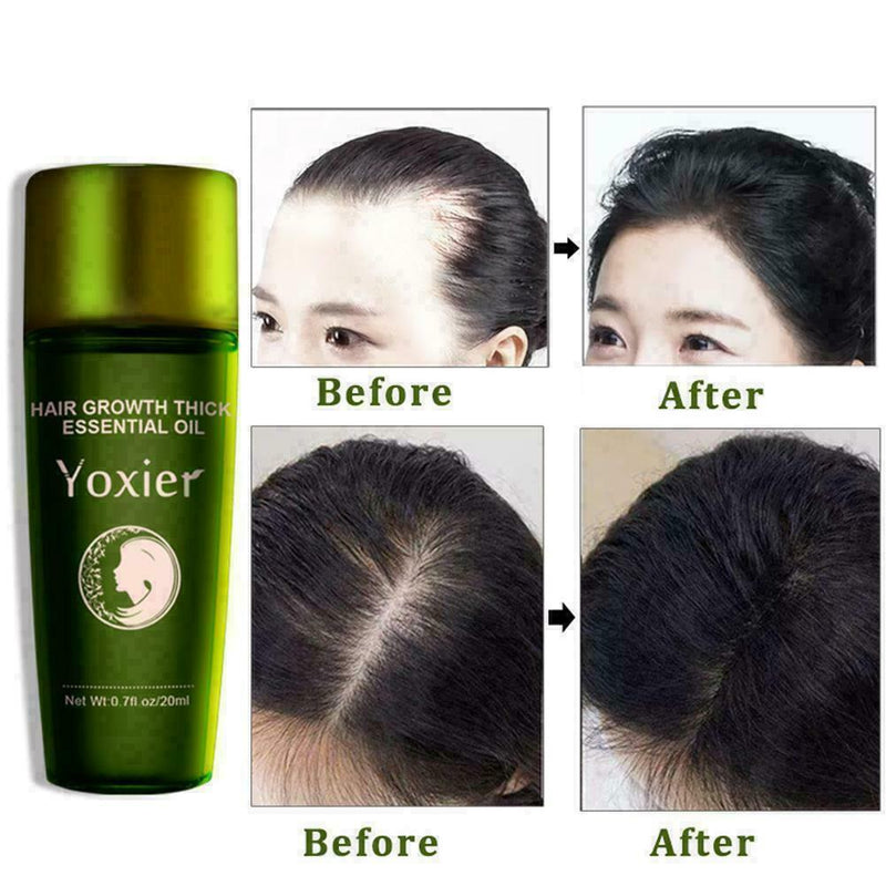 Herbal Hair Growth Essential Oil Improve Frizz Control Protect Hair Oil Sca P2A7
