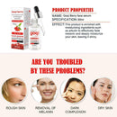 Lycium Essence Moisturizing Lifting Firming Facial Repair Serum 30ML Bright P1X5