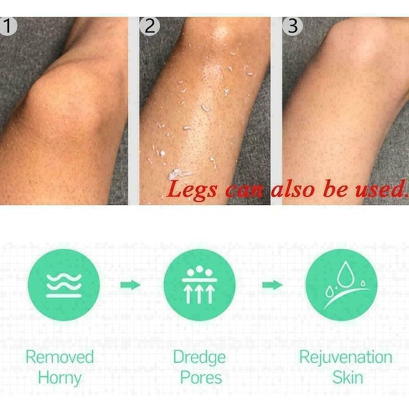 75g Peeling Gesichtsreiniger Peeling Creme Whitening Gesicht Peeling Mode T0A3