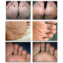 10pcs Ginger Massage Effervescent Tablets Treatment Anti-Swelling Foot SPA A