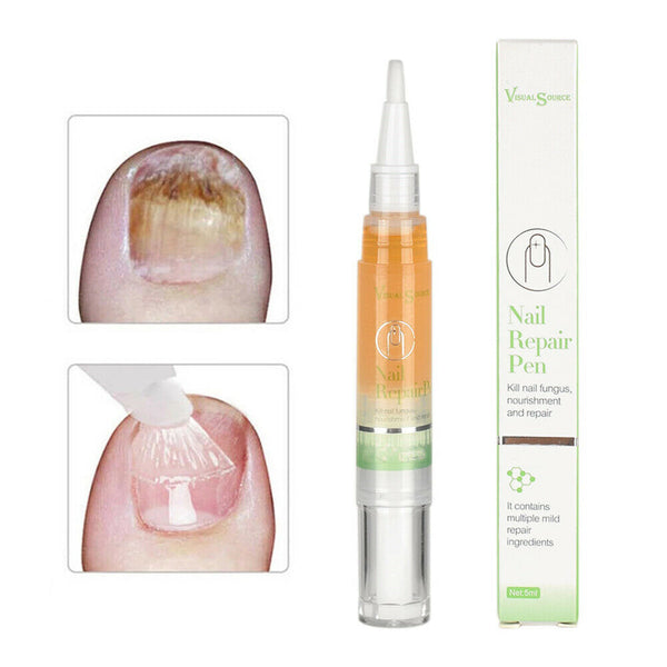 Nail Care Finger Edge Pen Nutrition Oil Pen Finger Edge Nourishing Liquid