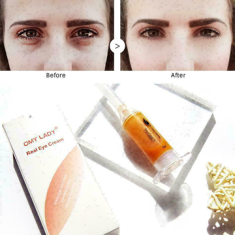 EyeCream Instant Remove Eyebags Anti Puffiness Dark Circles X6L3 R9T1 B8S4