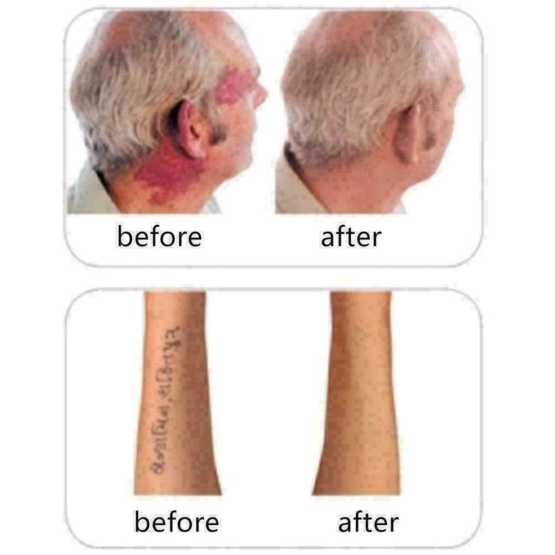 2* Skin Camouflage Make-Up Concealer For Tattoo, Scar Birthmark Up-UK- Cove L8B2