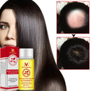 20ml Natural Ginger Extract Essential Oil Fast Hair Growth Loss Treatment â„–[