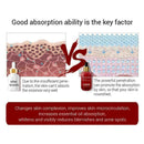 15ml Soins de la peau Blanchissant Huile Essentielle Vitamine S1Y0 SÃƒÂ©rum C W8Y2