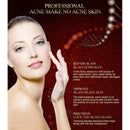 15ml Crema Acne para ELIMINA Barros Manchas Espinillas RECUP Tu I8P7 Piel L X4L1