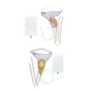 2x Reuseable Mens Urinal Pee Holder Collector Incontinent Aid 1000ml Bladder