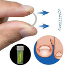 Ingrown Toenail Tool Correction Patch-Ingrown Toenail Lifter and File Ingrown
