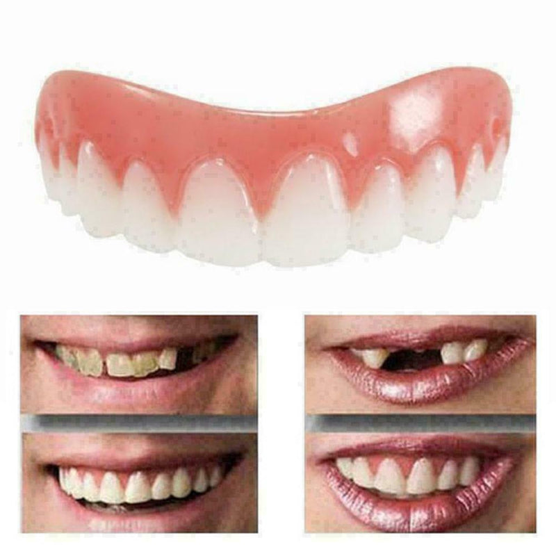 Teeth Brace 1Pcs/Set Temporary Smile Comfort Magic J6A4 Tee J4V Cosmetic W4P6