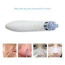 Facial Acne Blackhead Remover Vacuum Suction Pore Clean Machine (White B) SN9F