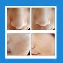 5 In 1 Electric Facial Cleansing Brush Facial Cleanser Device for Women