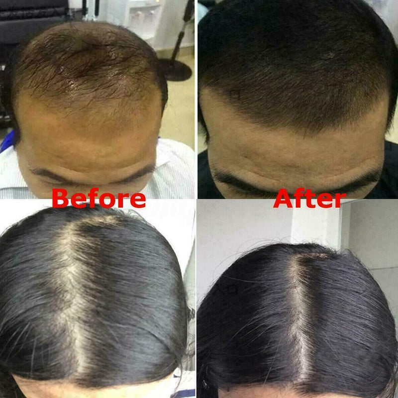 Useful Natural Ginger Oil-Control Shampoo Anti Dandruff Loss Hair Care Heal J9D9