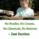 Mosquito Bites Extraction Itching Instant Bug Relief Bite Extraction Vacuum