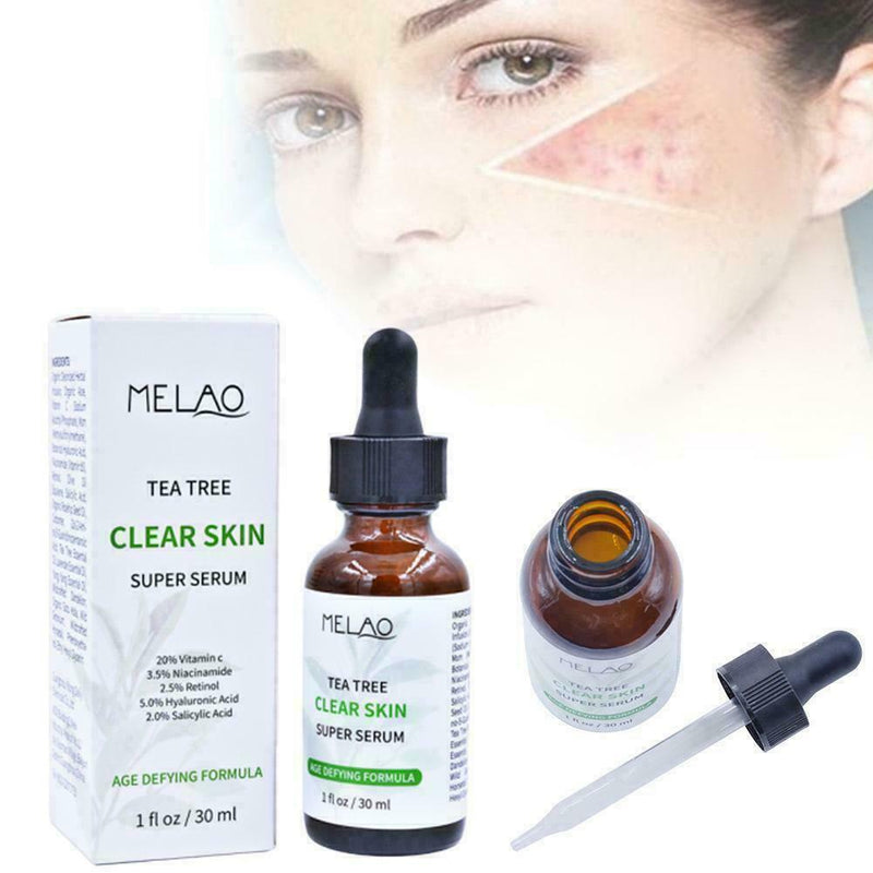 Pure Natural Tree Essential Oil Acne Treatment Face Z Skin Care Z1R9