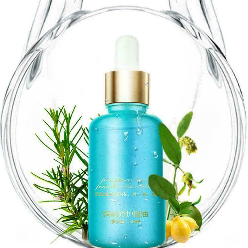 Best Essential oils For Stretch Marks remover strong Rem Y0T6 Marks30ml Str R2A8