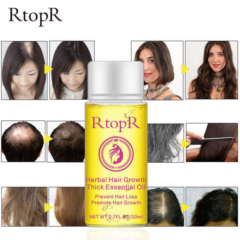 RtopR Herbal Hair Growth Anti Hair Loss Liquid Promote Thick Fast Hair Grow F5Y7