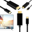 1.8m USB 3.1 Type-C to HDMI Cable 1080P HD Video Display Projector Adapter