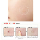 15Pcs iInvisible acne pimple master patches face scar care treatment stickers.AU