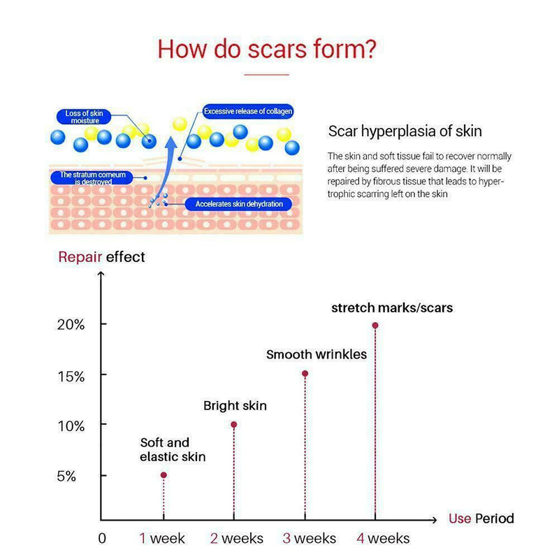 Trilogy Certified Organic Rosehip Oil 20ml (Rosa Canina Seed Oil) 2019 R9R3