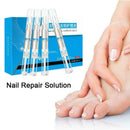 4Pcs Nail Liquid Pen Cuticle Remover Onychomycosis Nail Fungus Care Liquid I5N3