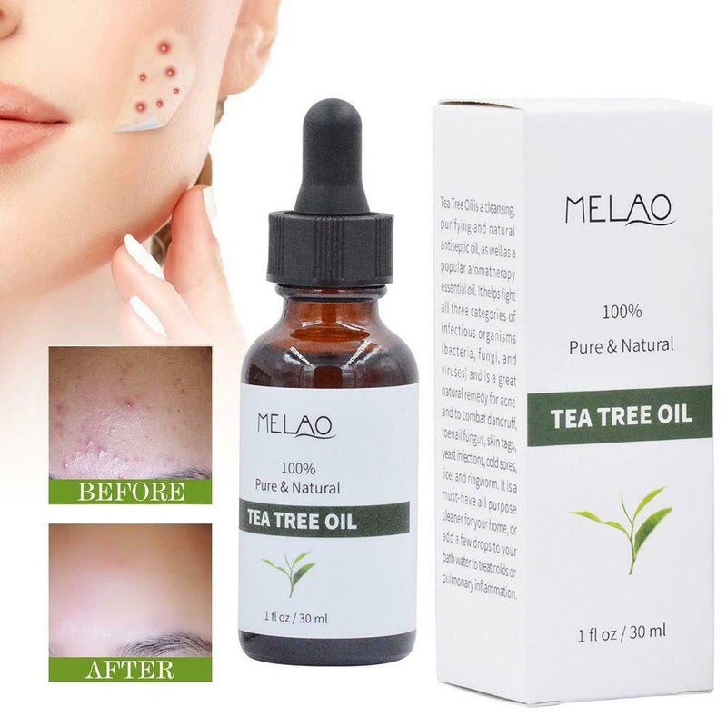 Essential Oils Tea Tree Essential Oil Relieves common skin irritations Chapped