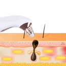 Blackhead Remover Black Dot Vacuum Cleaner Vacuum Suction Skin Pore Cleaner